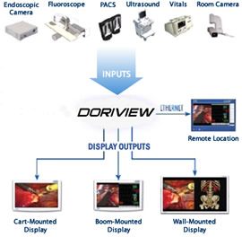 DORIVIEW multi-suite integrated operating room system.